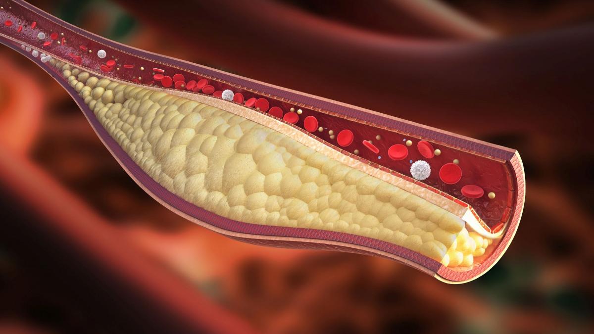 Cholesterol Table: What to Eat